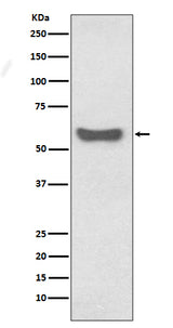Anti-IgA Rabbit Monoclonal Antibody Boster Bio