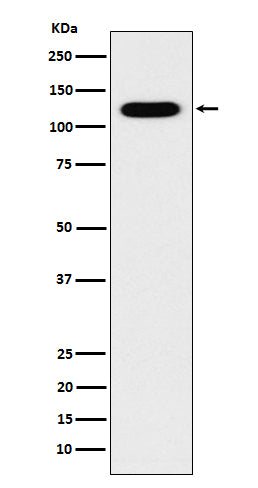 Anti-Cadherin 16 CDH16 Monoclonal Antibody Boster Bio