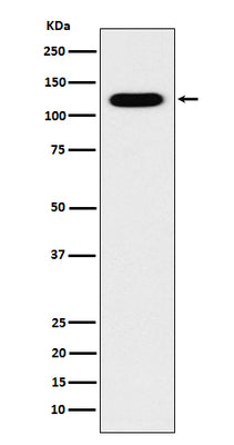Anti-Cadherin 16 CDH16 Monoclonal Antibody Boster Bio