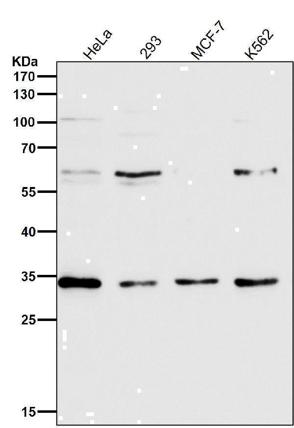 Anti-NUDT5 Rabbit Monoclonal Antibody Boster Bio
