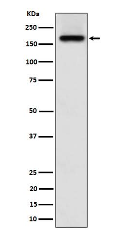 Anti-SARA Rabbit Monoclonal Antibody Boster Bio