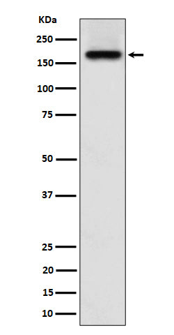 Anti-SARA Rabbit Monoclonal Antibody Boster Bio