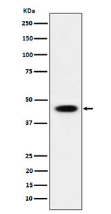 Anti-AdSS 2 Rabbit Monoclonal Antibody Boster Bio