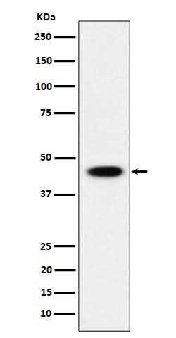 Anti-AdSS 2 Rabbit Monoclonal Antibody Boster Bio
