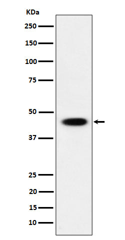 Anti-AdSS 2 Rabbit Monoclonal Antibody Boster Bio