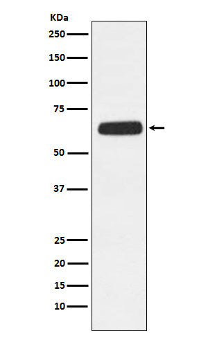 Anti-CD89 Rabbit Monoclonal Antibody Boster Bio