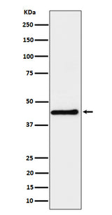 Anti-DPF2 Rabbit Monoclonal Antibody Boster Bio