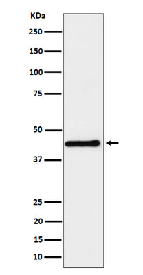 Anti-DPF2 Rabbit Monoclonal Antibody Boster Bio