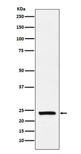 Anti-Casein Rabbit Monoclonal Antibody Boster Bio