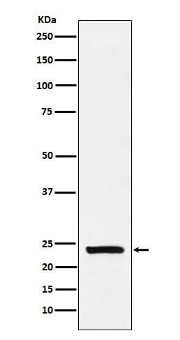 Anti-Casein Rabbit Monoclonal Antibody Boster Bio