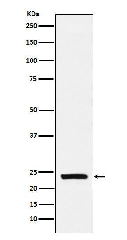 Anti-Casein Rabbit Monoclonal Antibody Boster Bio
