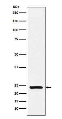 Anti-Casein Rabbit Monoclonal Antibody Boster Bio