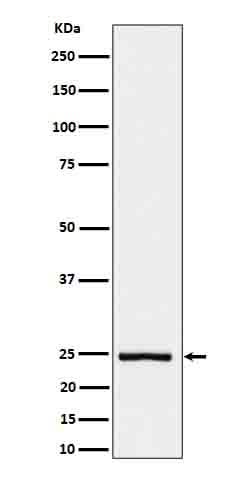 Anti-IL26 Rabbit Monoclonal Antibody Boster Bio