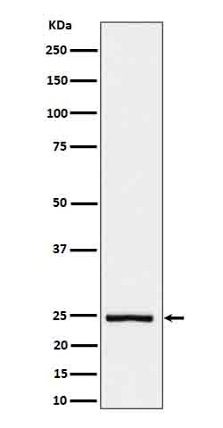 Anti-IL26 Rabbit Monoclonal Antibody Boster Bio