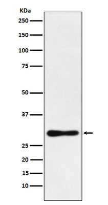 Anti-DDAH2 Monoclonal Antibody Boster Bio