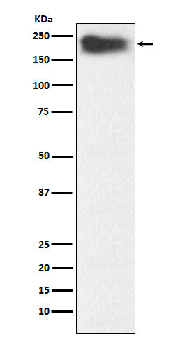 Anti-MYH7B Rabbit Monoclonal Antibody Boster Bio