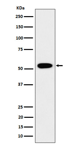 Anti-GRSF1 Rabbit Monoclonal Antibody Boster Bio