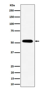 Anti-PPP2R5E Rabbit Monoclonal Antibody Boster Bio