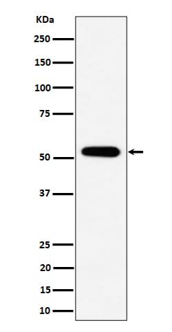 Anti-PPP2R5E Rabbit Monoclonal Antibody Boster Bio