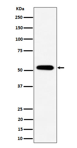 Anti-PPP2R5E Rabbit Monoclonal Antibody Boster Bio