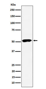 Anti-PPP2R5E Rabbit Monoclonal Antibody Boster Bio