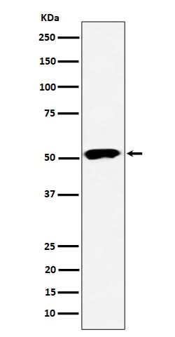 Anti-PPP2R5E Rabbit Monoclonal Antibody Boster Bio