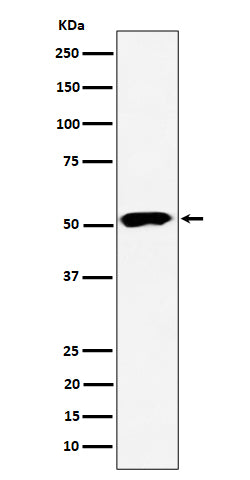 Anti-PPP2R5E Rabbit Monoclonal Antibody Boster Bio