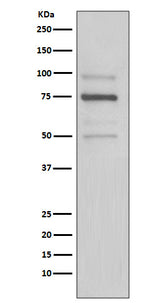Anti-KDEL Rabbit Monoclonal Antibody Boster Bio