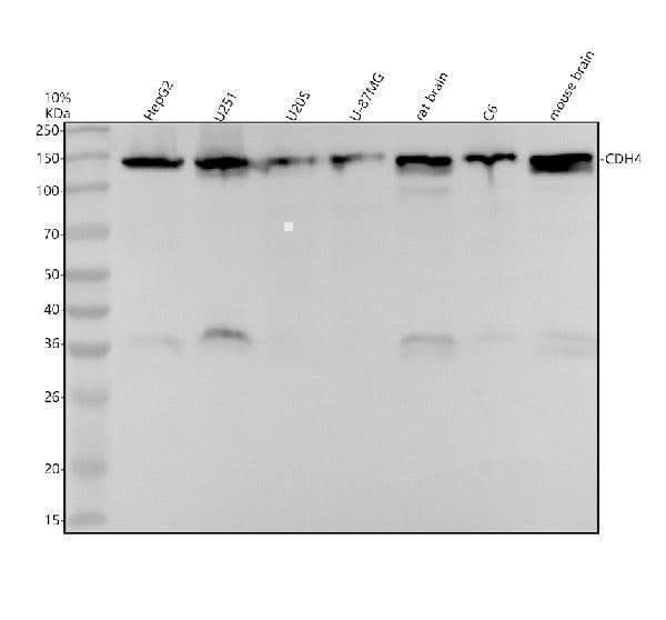 Anti-R Cadherin Rabbit Monoclonal Antibody Boster Bio
