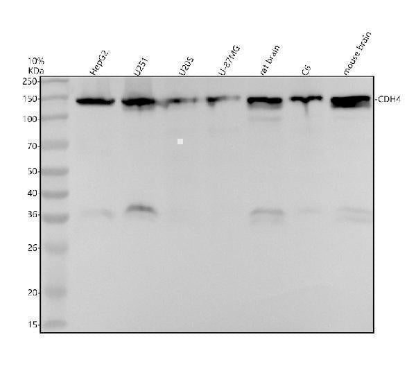 Anti-R Cadherin Rabbit Monoclonal Antibody Boster Bio