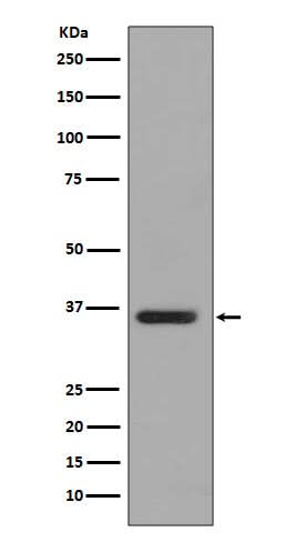 Anti-PP2A alpha + beta Rabbit Monoclonal Antibody Boster Bio