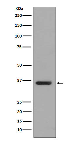 Anti-PP2A alpha + beta Rabbit Monoclonal Antibody Boster Bio