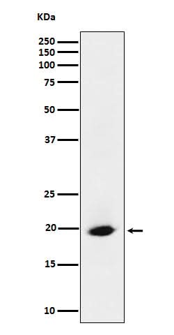 Anti-SRP19 Rabbit Monoclonal Antibody Boster Bio