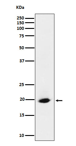 Anti-SRP19 Rabbit Monoclonal Antibody Boster Bio
