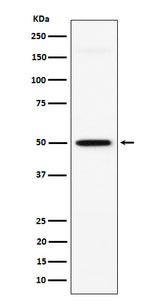 Anti-GPA33 Rabbit Monoclonal Antibody Boster Bio