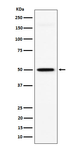 Anti-GPA33 Rabbit Monoclonal Antibody Boster Bio
