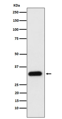 Anti-Apolipoprotein F Rabbit Monoclonal Antibody Boster Bio