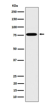 Anti-DPP3 Rabbit Monoclonal Antibody Boster Bio