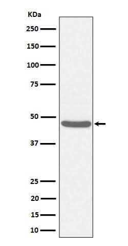 Anti-BCKDK Rabbit Monoclonal Antibody Boster Bio