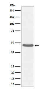 Anti-BCKDK Rabbit Monoclonal Antibody Boster Bio