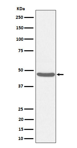Anti-BCKDK Rabbit Monoclonal Antibody Boster Bio