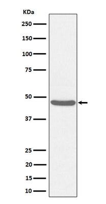 Anti-BCKDK Rabbit Monoclonal Antibody Boster Bio