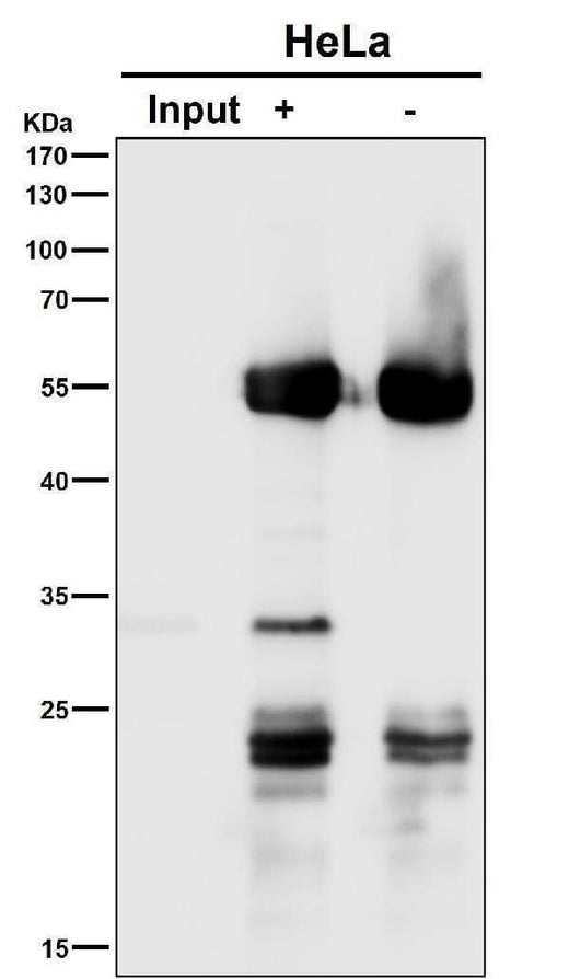 Anti-Apg10 (Atg10) Rabbit Monoclonal Antibody Boster Bio