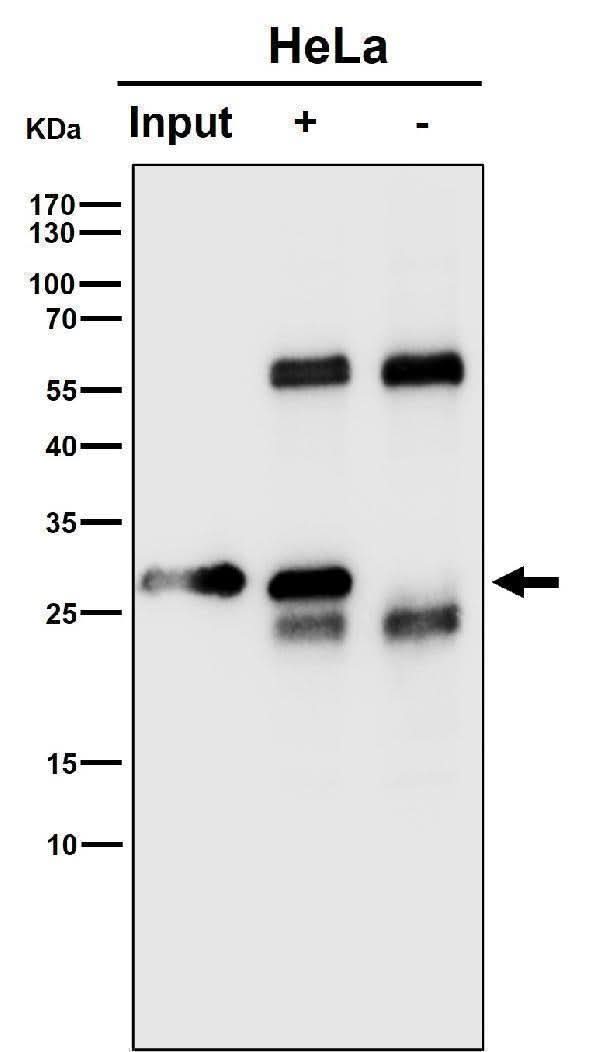 Anti-RPS8 Rabbit Monoclonal Antibody Boster Bio