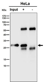 Anti-RPS8 Rabbit Monoclonal Antibody Boster Bio