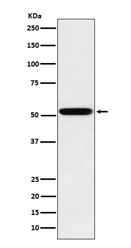 Anti-Human IgG2 Rabbit Monoclonal Antibody Boster Bio