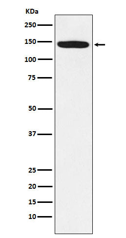 Anti-HTSF1 Rabbit Monoclonal Antibody Boster Bio