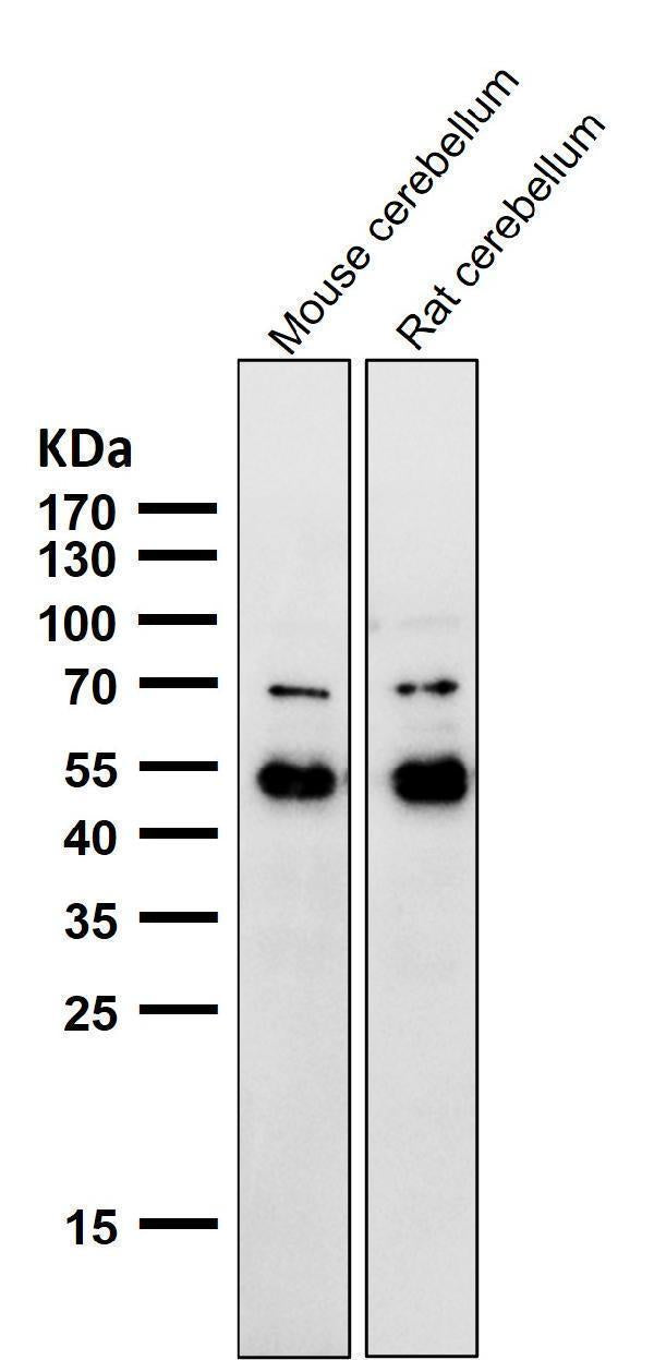 Anti-NeuroD2 Rabbit Monoclonal Antibody Boster Bio
