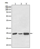 Anti-NDUFB8 Rabbit Monoclonal Antibody Boster Bio