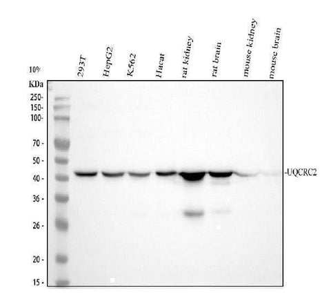 Anti-UQCRC2 Monoclonal Antibody Boster Bio